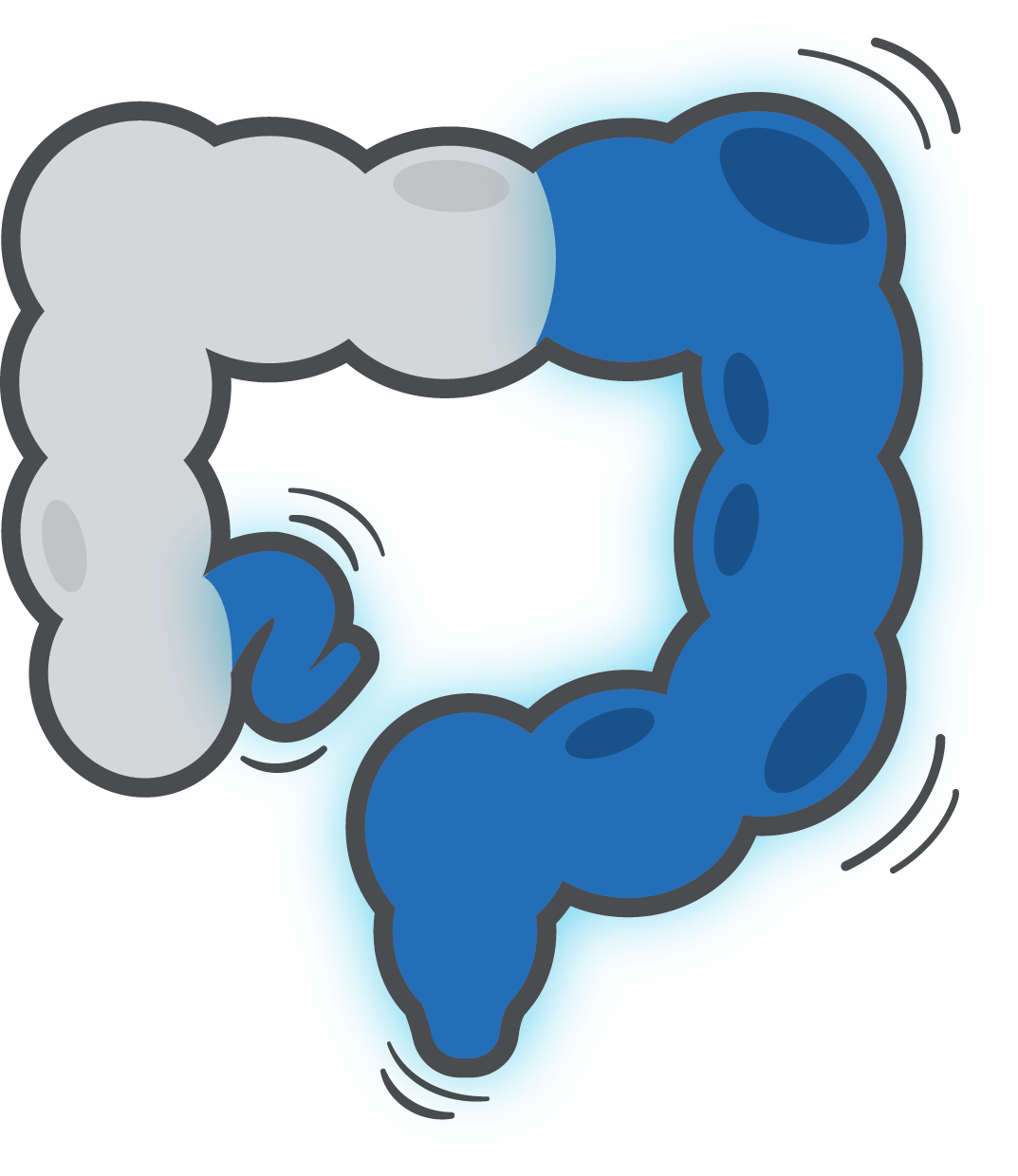 Inflammatory Bowel Disease
