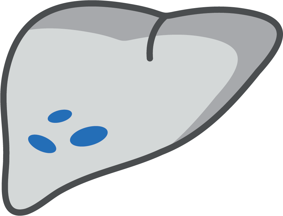 Fatty Liver Disease (MASLD)